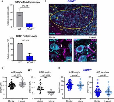 Brain-Derived Neurotrophic Factor Is Involved in Activity-Dependent Tonotopic Refinement of MNTB Neurons